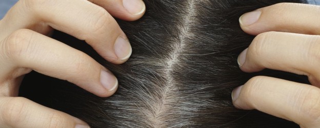 How to treat excess sebum and hair loss