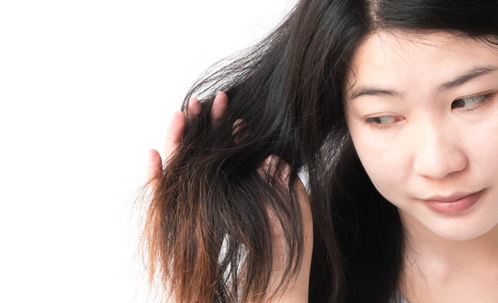 kvinna-skadat-håravfall-allvarliga-orsaker-behandlingar
