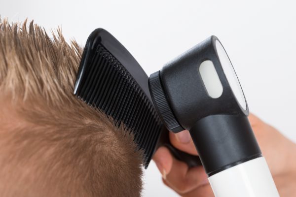 doctor examines male patient hair dermatoscope male normal hair loss viviscal blog