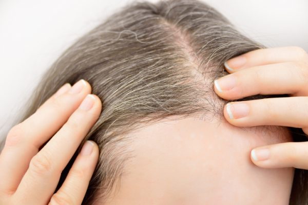 aging hair loss gray hairs thinning hair scalp part closeup viviscal hair blog