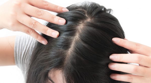 ampia parte i capelli neri donna telogen effluvium perdita dei capelli viviscal capelli blog