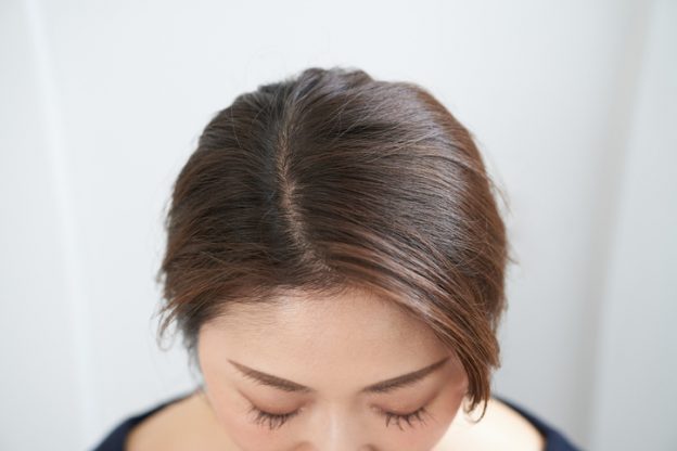 scalp treatment for thinning hair