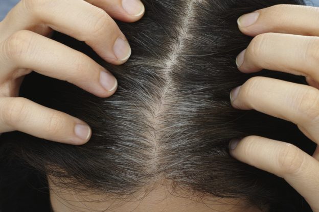 how to slow down gray hair naturally