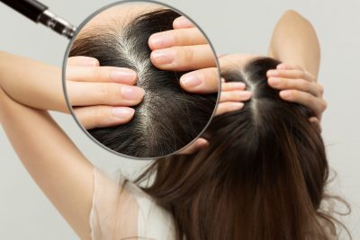 how to reopen hair follicles